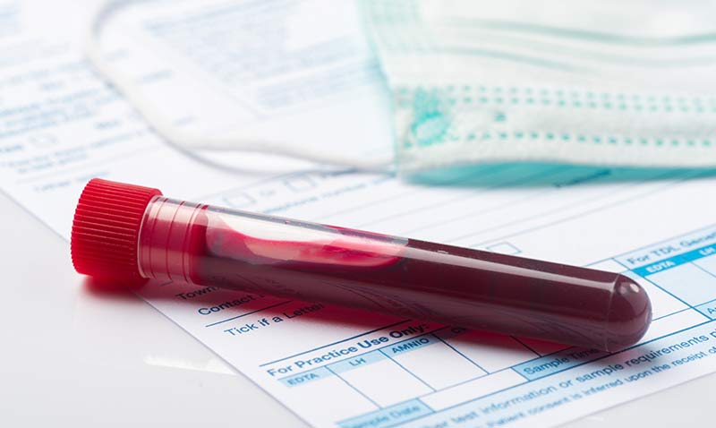 Modern zamanlarn korkulu ryas: AIDS