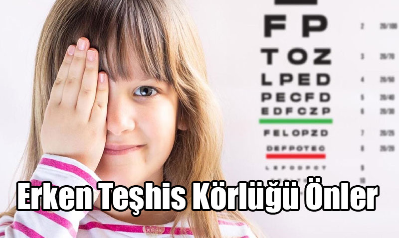 Erken Teşhis Körlüğü Önler: Göz Sağlığı İçin 10 Kritik Kural
