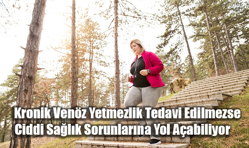 Kronik Venz Yetmezlik Tedavi Edilmezse Ciddi Salk Sorunlarna Yol Aabiliyor