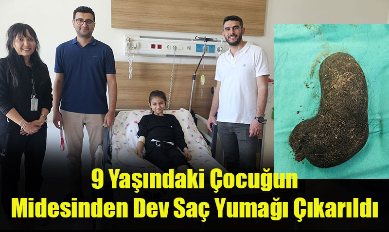 Eskişehir Şehir Hastanesi’nde Nadir Bir Vaka