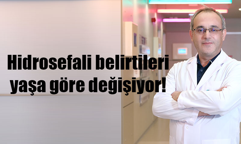 Hidrosefali: Beyinde Su Toplanması Hastalığı