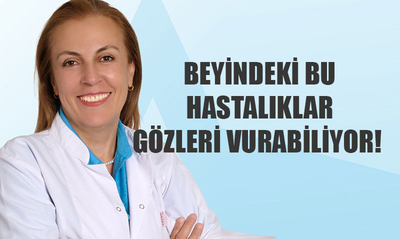 Göz Sorunları Beyin Hastalıklarının Sinyali Olabilir