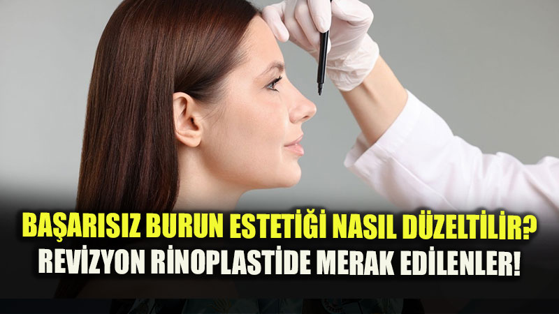 Ba�ar�s�z Burun Esteti�i Nas�l D�zeltilir? Revizyon Rinoplastide Do�ru Zamanlama Ve Y�ntemler