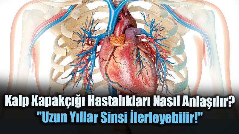 Kalp Kapak���� Hastal�klar� Nas�l Anla��l�r? "Uzun Y�llar Sinsi �lerleyebilir!"