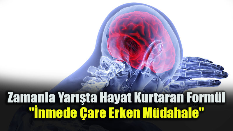 �nme Kader De�il: T�rk Beyin Damar Hastal�klar� Derne�i�nden Kritik Uyar�lar